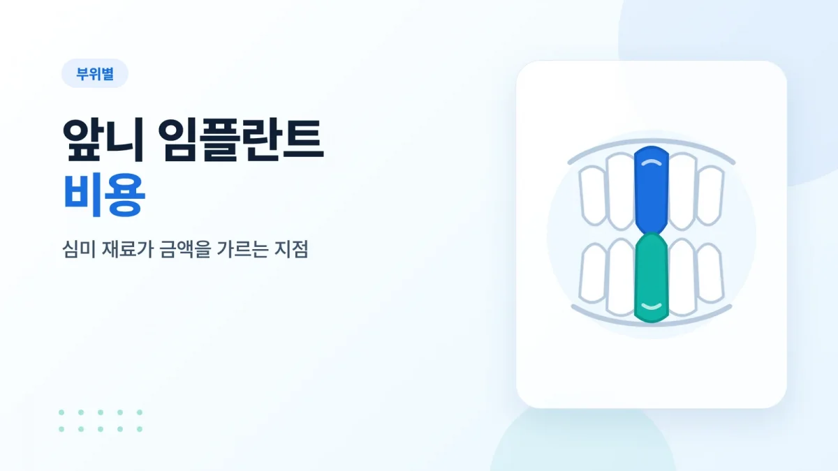 앞니 임플란트 비용 썸네일